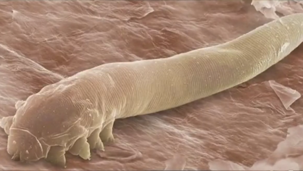 mites